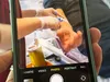 Пацієнти знімають лікування для TikTok без дозволу лікарів