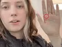 ChatGPT виявив небезпечну родимку під час віртуального читання долоні