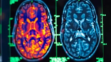Ілюстративне зображення SciTechDaily